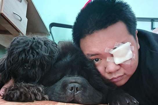 After the dog accidentally hurt the man's eye, he acted very clingy. This is because he is afraid that his owner will leave.