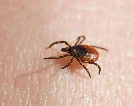 Pictures of young man's feet covered with ticks